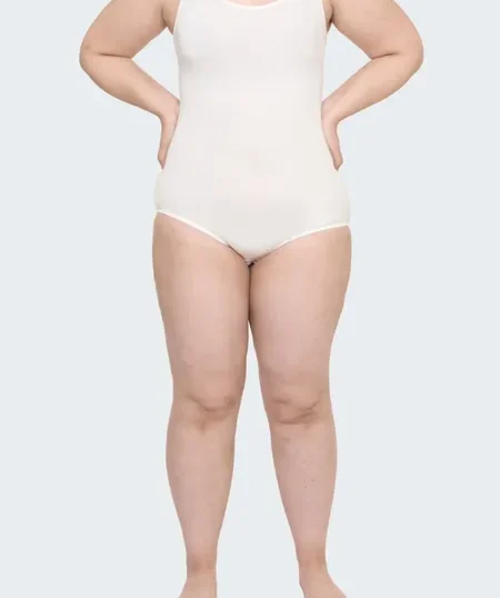 lipedema-grado-1